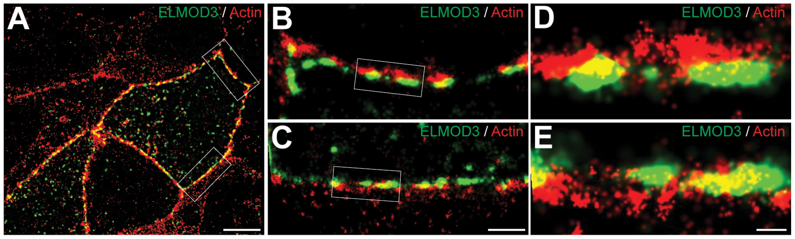 ELMOD3 is localized at the plasma membrane.