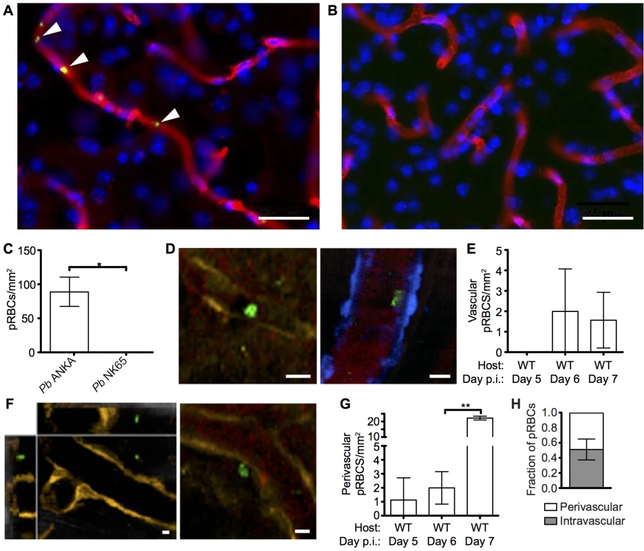 pRBCs make transient adhesive contact with endothelial cells and are deposited within the perivascular space of the meninges of mice with ECM.