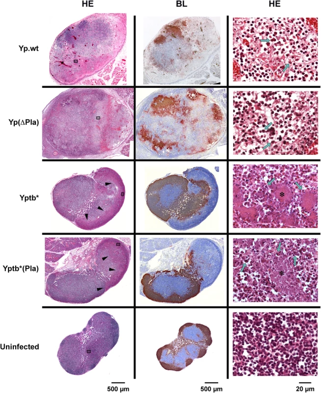 Histology of dLNs infected with <i>Y</i>. <i>pestis</i> or <i>Y</i>. <i>pseudotuberculosis</i> strains containing or not the pPla plasmid.