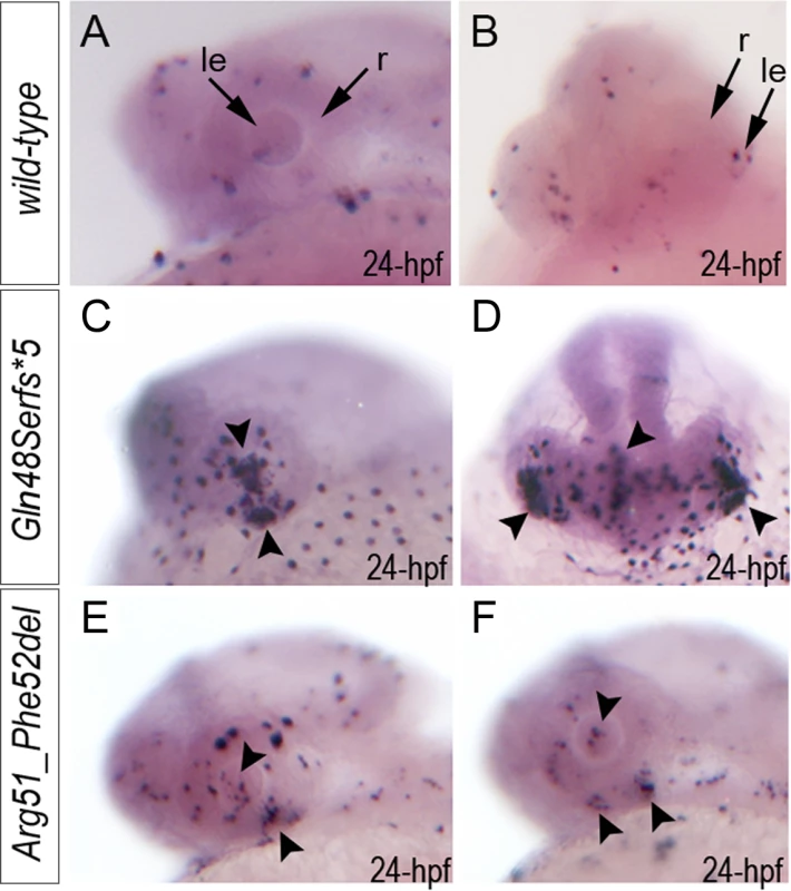 Summary of TUNEL assays in zebrafish wild-type and <i>mab21l2</i> mutant embryos.