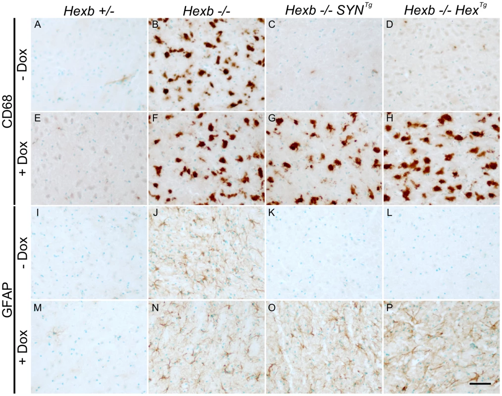 Induction of neuroinflammation by doxycycline-mediated suppression of transgenic <i>Hexb</i>.
