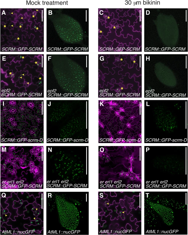 Bikinin treatment represses GFP-SCRM accumulation independent of EPF2-and ERECTA-family.