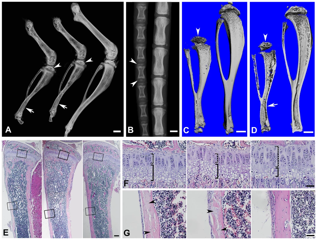 Bone defects in the 6-week-old <i>Fam20c</i>-cKO mice revealed by X-ray and histology.