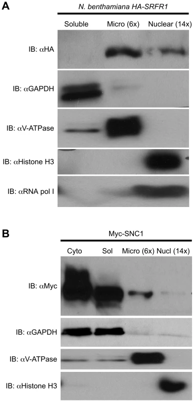 Localization of SRFR1 and SNC1 expressed in <i>N. benthamiana</i>.
