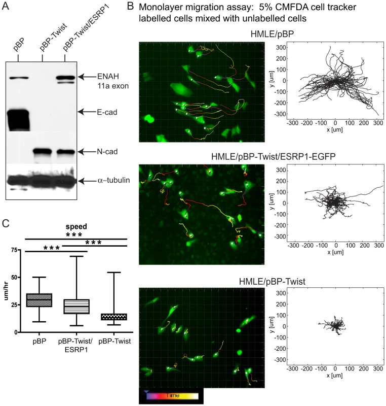Expression of ESRP1 confers epithelial migration properties to mesenchymal cells.