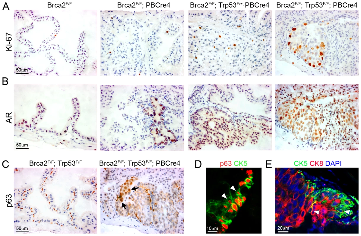 <i>Brca2;Trp53</i> mutant prostates have hallmarks of cancer.