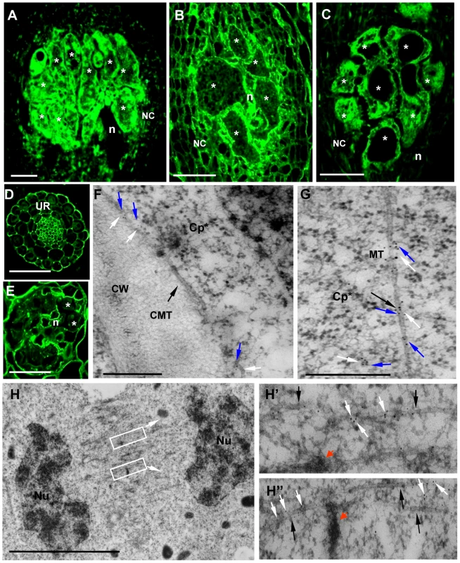 Immunofluorescence Detection of γ-Tubulin on Galls and Roots in Mutants and Wild-Type <i>Arabidopsis</i> seedlings.