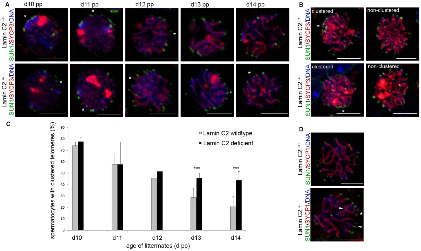 Bouquet release is significantly delayed in <i>lamin C2<sup>−/−</sup></i> spermatocytes.