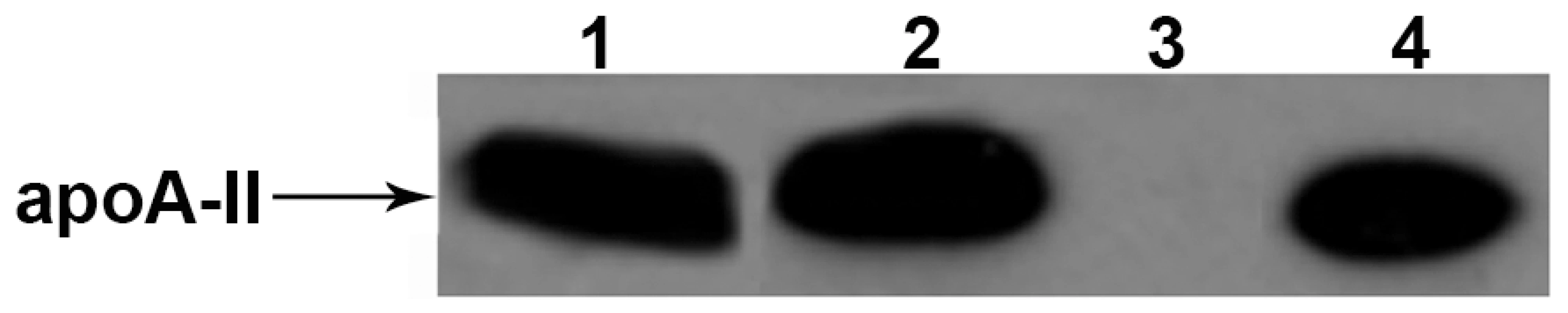 Western blot analysis of amyloid fibril fractions extracted from muscles used for secondary transmission.