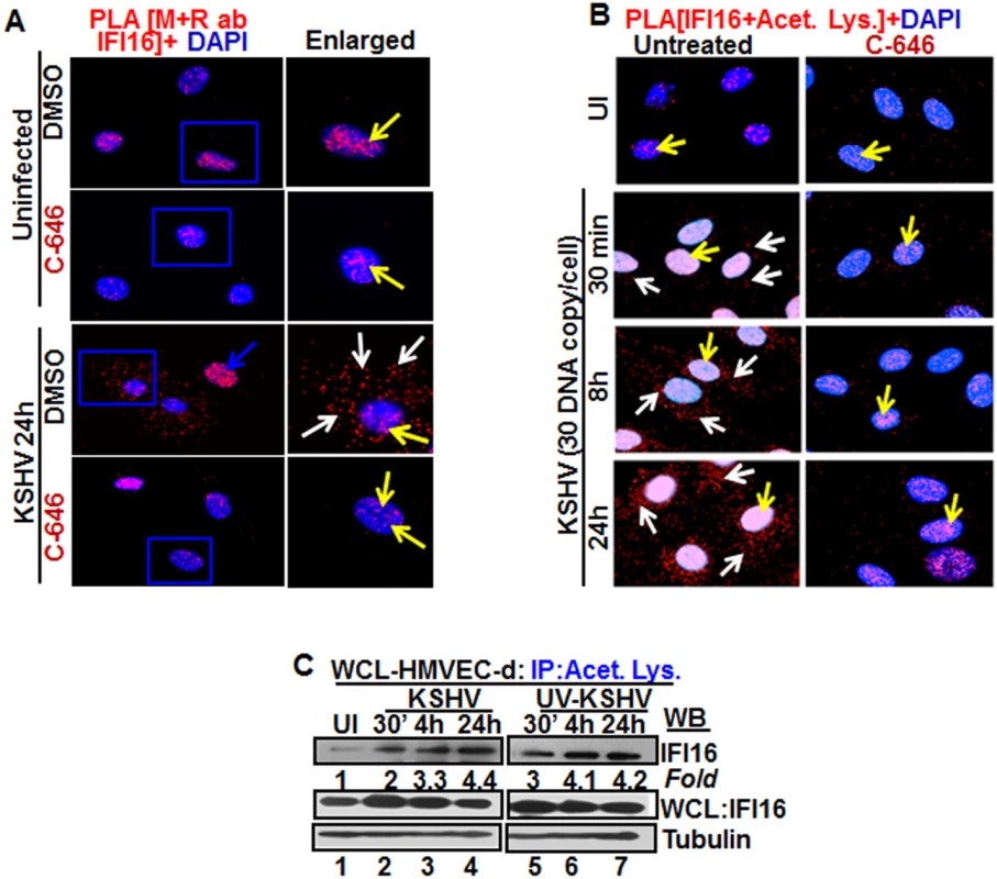 Proximity Ligation Assay (PLA) of IFI16’s acetylation and cytoplasmic redistribution during <i>de novo</i> KSHV infection of HMVEC-d cells.