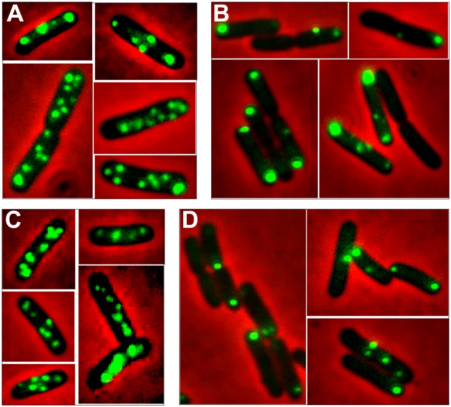 Localization of plasmid R388 and derivatives in live <i>E. coli</i> cells using a <i>parS</i>/GFP-ParB system.