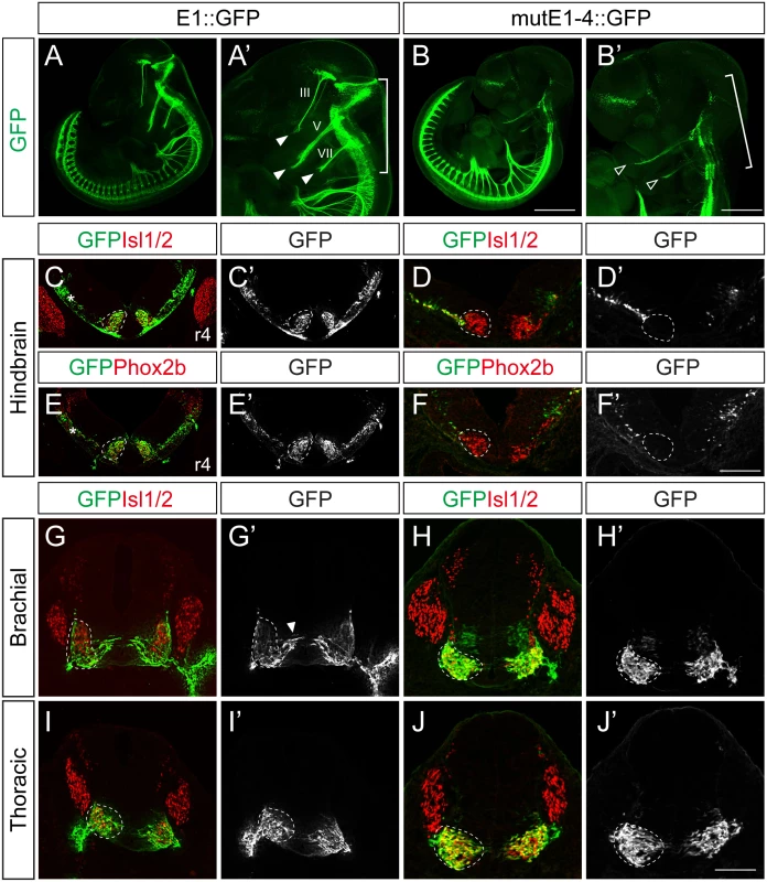 Characterization of E1::GFP and mutE1-4::GFP transgenic mice.