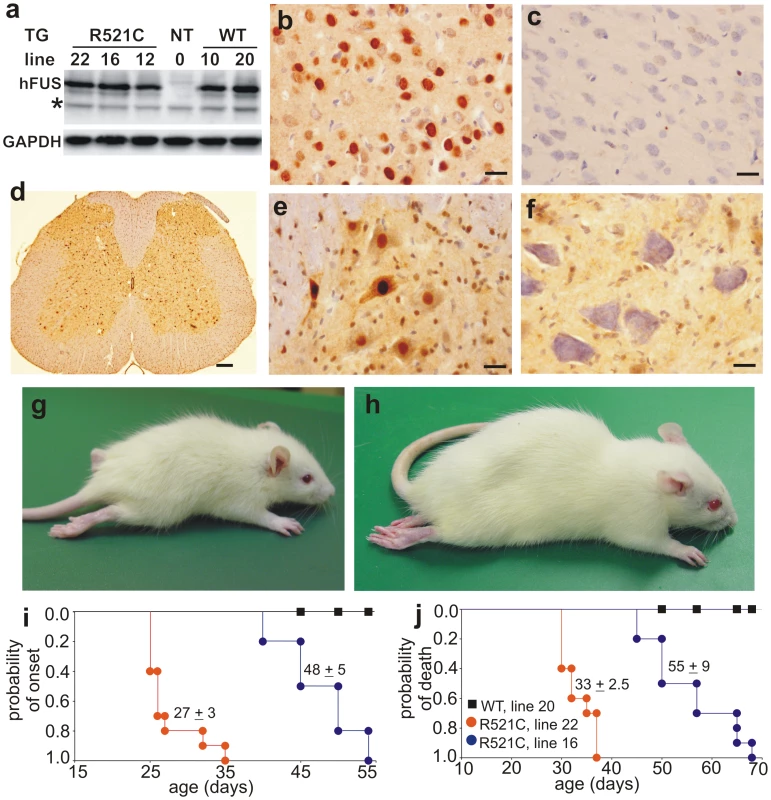 Progressive paralysis in transgenic rats overexpressing a mutant human FUS.