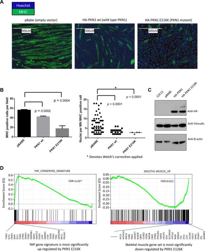 PKN1 E216K mutation prevented muscle differentiation in C2C12 mouse myoblasts.