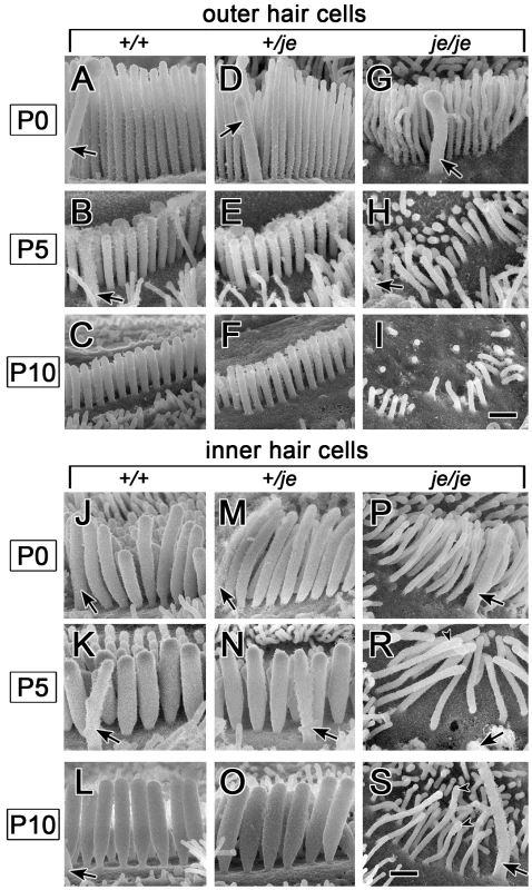 Stereociliary dimensions for basal-region cochlear hair cells in early postnatal <i>+/+</i>, <i>+/je</i>, and <i>je/je</i> mice.