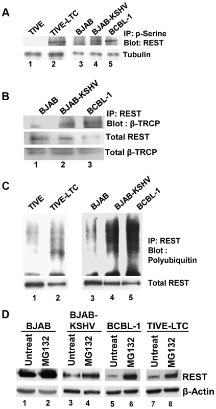 Phosphorylation and ubiquitination of REST in the cytoplasm of KSHV infected cells.