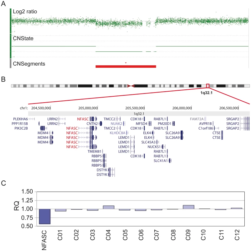 Molecular karyotyping and MLPA confirmation of identified loci.