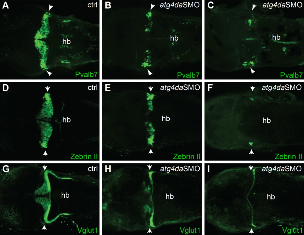 Suppression of <i>atg4da</i> in zebrafish leads to loss of cerebellar neurons.