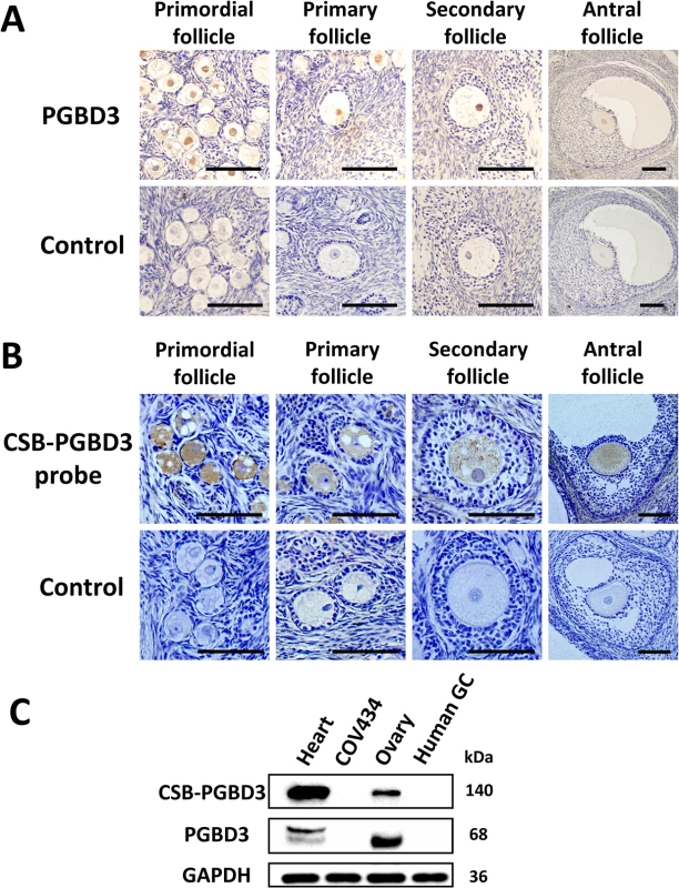 The cellular localization of PGBD3 and CSB-PGBD3.