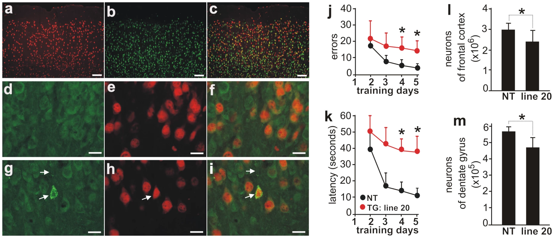 Neuron loss accompanied by ubiquitin aggregation in aged rats overexpressing the normal human <i>fus</i> gene.