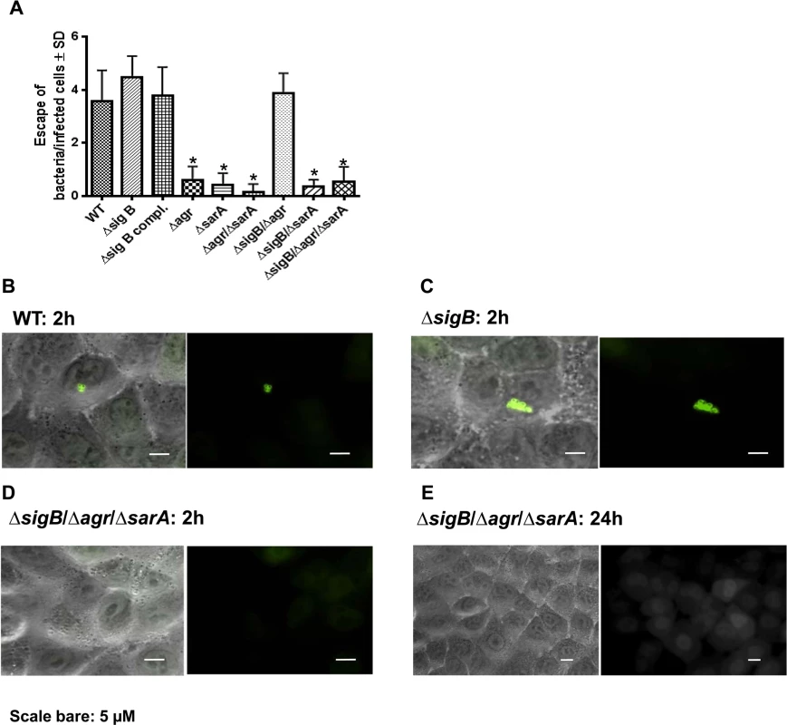 Phagosomal escape of wild-type strain LS1 and corresponding mutants after infection of the host cell construct A549YFP-CWT.