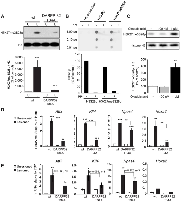 L-DOPA induced H3K27me3S28 phosphorylation and gene activation are dependent on a functional PP1 interaction site on DARPP-32.