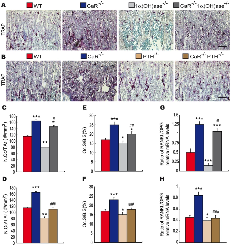 Effects of deletion of 1α(OH)ase or PTH on osteoclastic bone resorption in CaR–deficient mice.