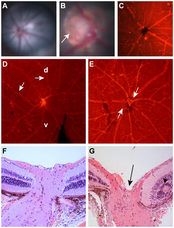 Clinical ocular phenotype in C57BL/6-<i>Pax2<sup>+/A220G</sup></i> mice compared to wild-type, C57BL/6 mice.