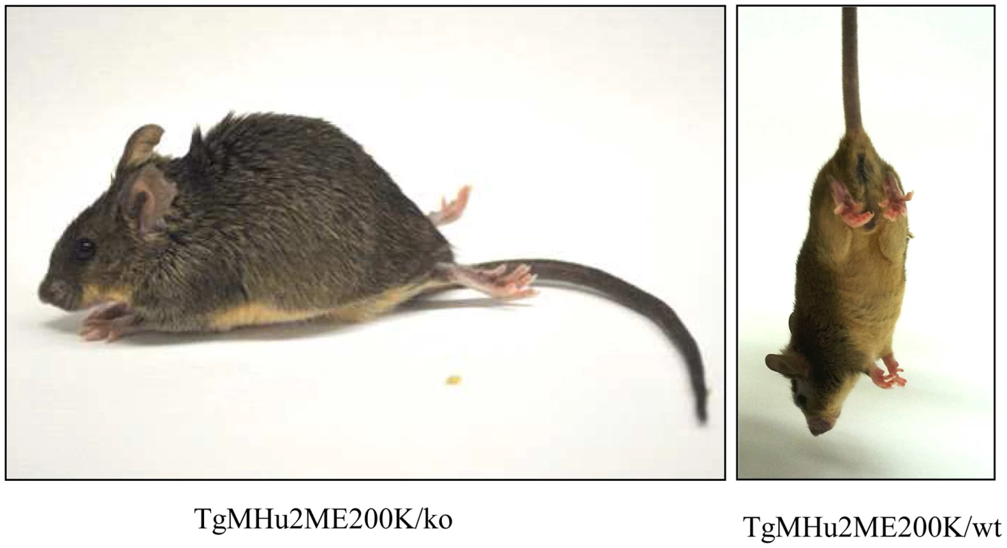 Clinical Characterization of spontaneous disease in TgMHu2ME199K mice.