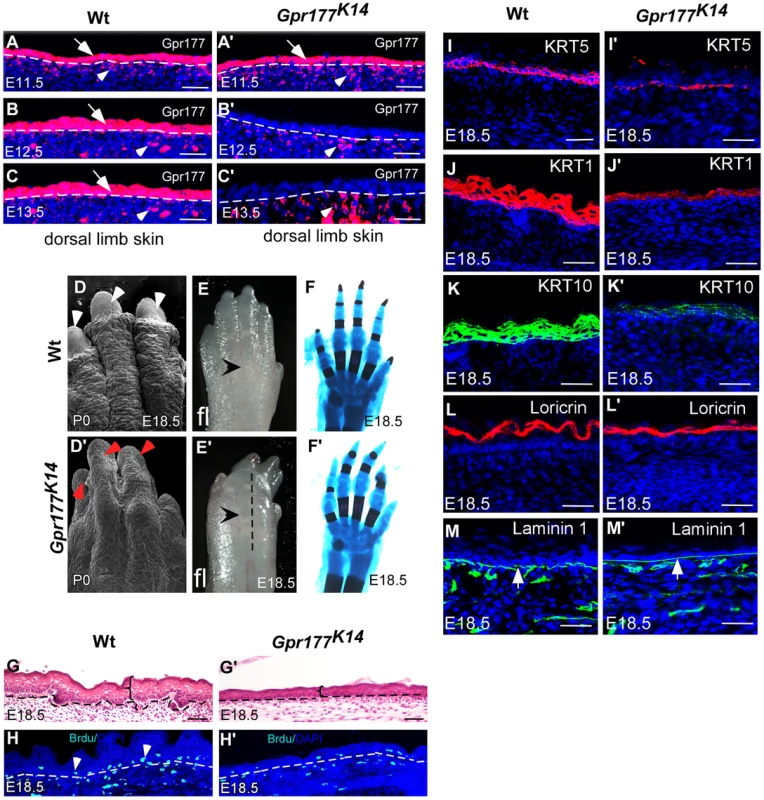 Deletion of <i>Gpr177</i> in embryonic epidermis results in skin defects attributing to hypoplastic spinous layer.