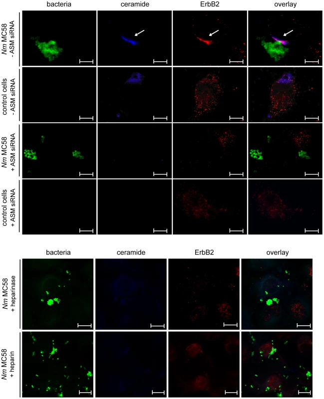 <i>N. meningitidis</i> infection promotes ErbB2 recruitment in ceramide-enriched platforms.