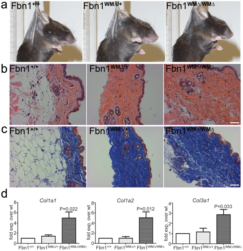 Thick skin phenotype in WMΔ mice.