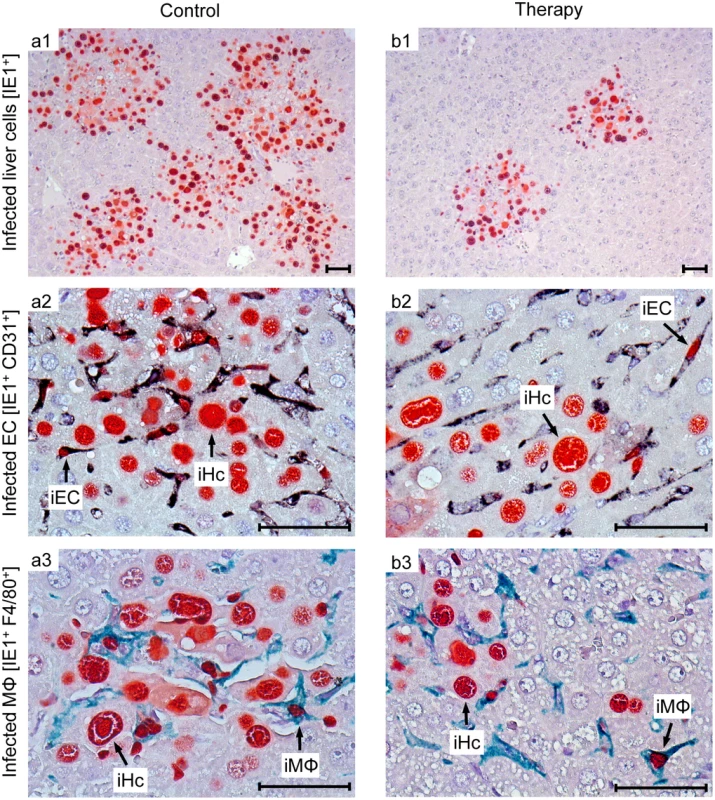 Reduced viral spread and histopathology in liver tissue, differentiated by infected cell type, as correlate of protection by human TCR<sub>NLV</sub>-transduced T cells.