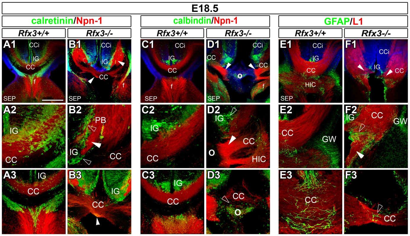 Abnormal callosal axon pathfinding in <i>Rfx3−/−</i> mice.