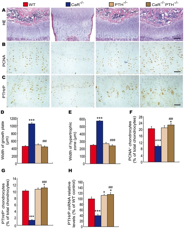 Effects of deletion of PTH on endochondral bone formation in CaR–deficient mice.