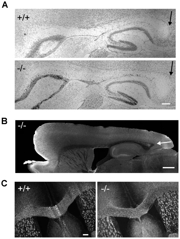 Absence of hypoplasia of posterior corpus callosum in β-III spectrin knockout mice.
