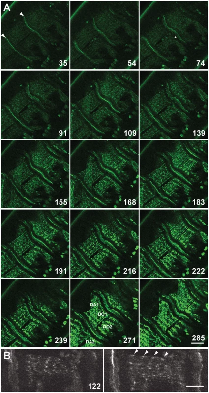 Live imaging of G00189 (GFP-Zasp52) during myofibril assembly of embryonic body wall muscles.