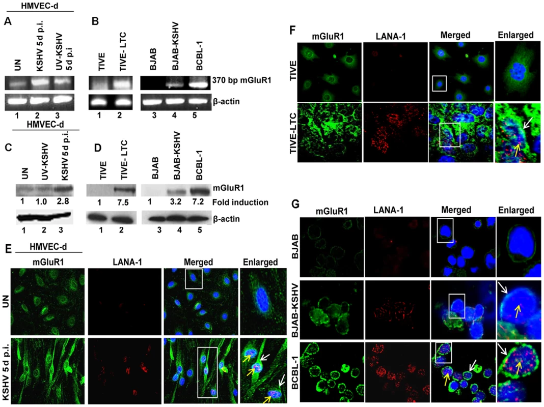 mGluR1 expression is upregulated in KSHV infected cells.