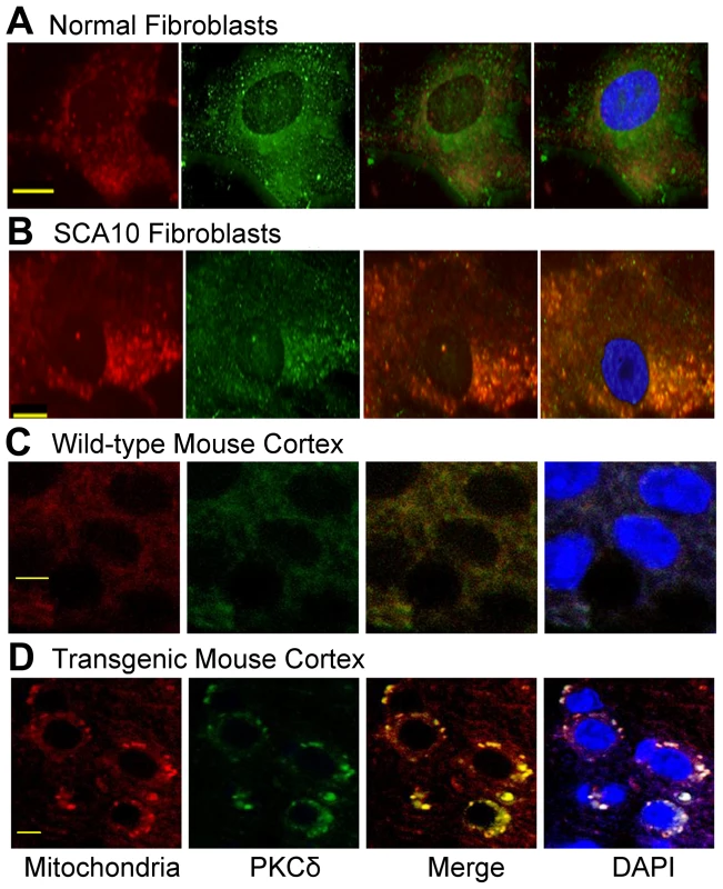 PKCδ is localized in mitochondria in SCA10 fibroblasts and transgenic mouse brain.