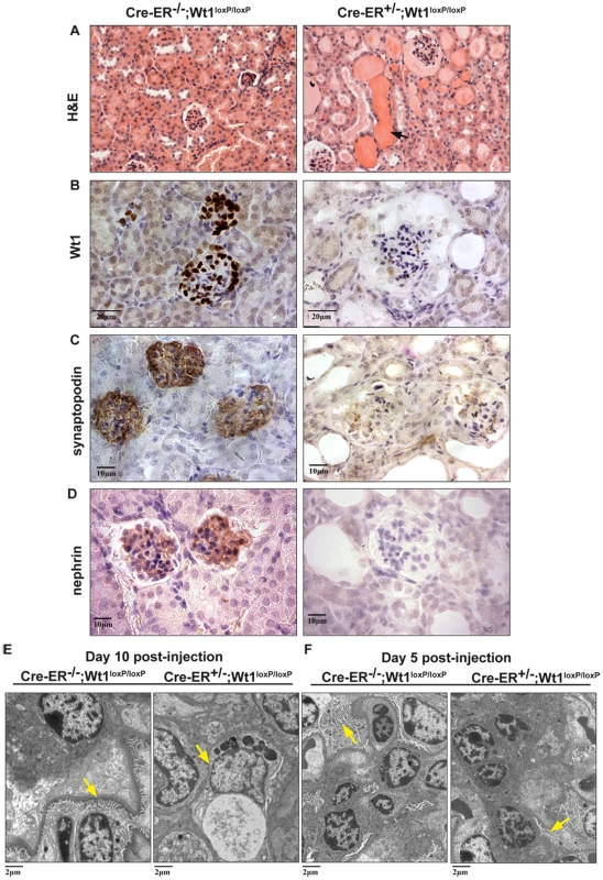 Severe kidney phenotype in the adult conditional &lt;i&gt;Wt1&lt;/i&gt; KOs.