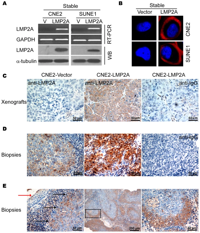 Endogenous and exogenous expression of LMP2A detected using monoclonal antibodies.