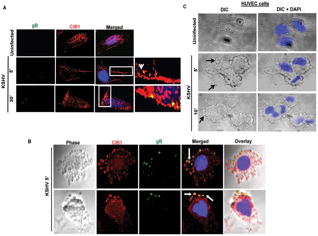 CIB1 association with KSHV in macropinocytic blebs early during <i>de novo</i> KSHV infection in endothelial cells.