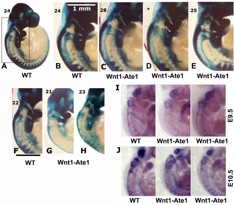 Wnt1-Ate1 mice have defects in neural crest cell migration.