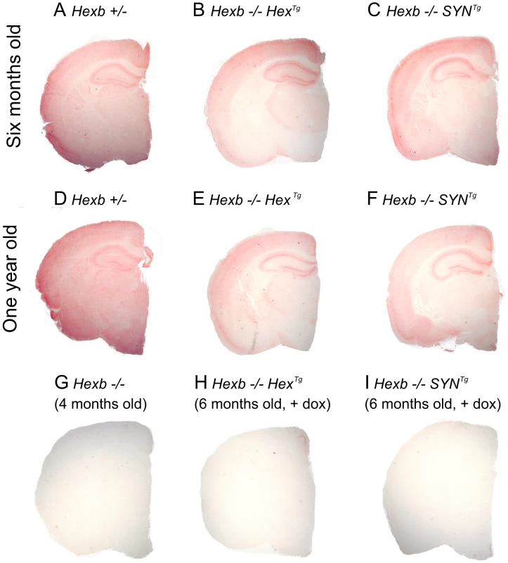 Pattern of β-hexosaminidase activity staining in transgenic mouse brain.