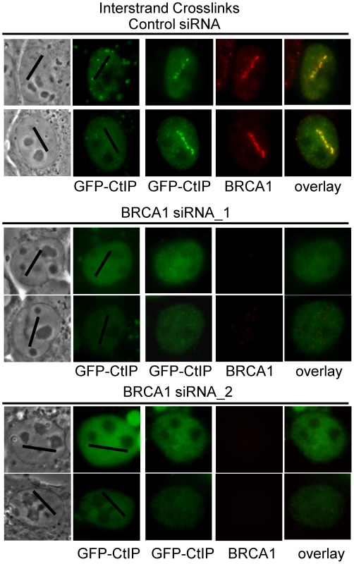 CtIP accumulation at ICLs is BRCA1–dependent.