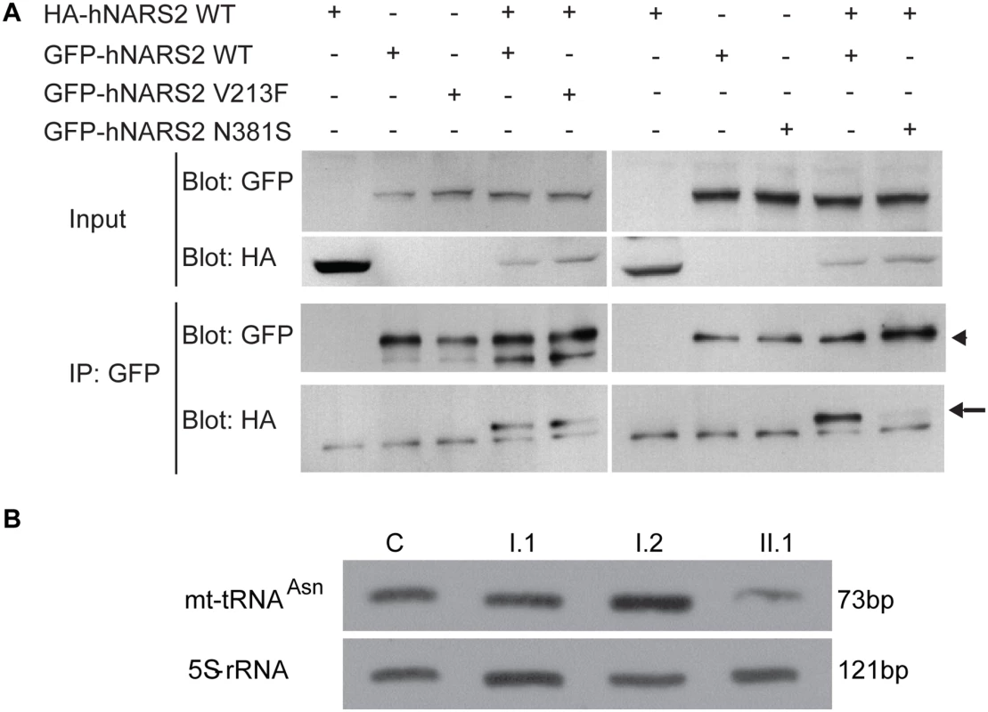 NARS2 homodimerization and RNA level: effect of the p.Val213Phe and p.Asn381Ser mutations.