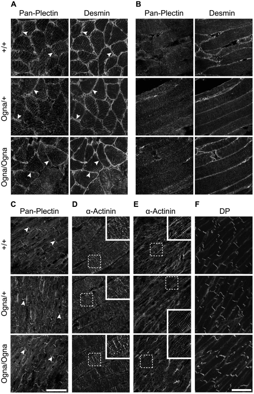 Normal plectin expression and contractile apparatus organization in muscle tissues of Ogna mice.