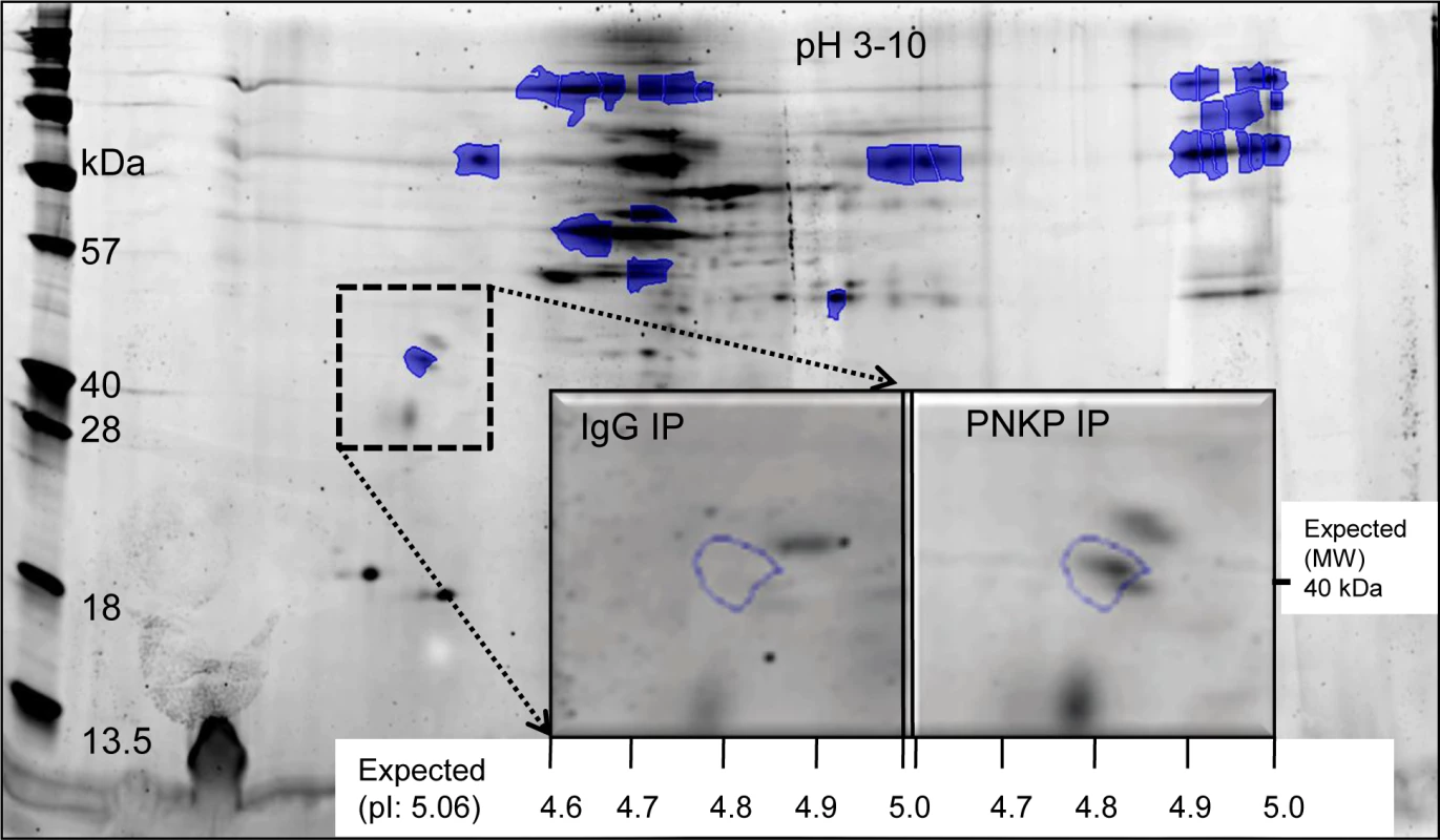 Identification of ATXN3 in the PNKP IP by 2D gel and MALDI-TOF-TOF MS analysis.