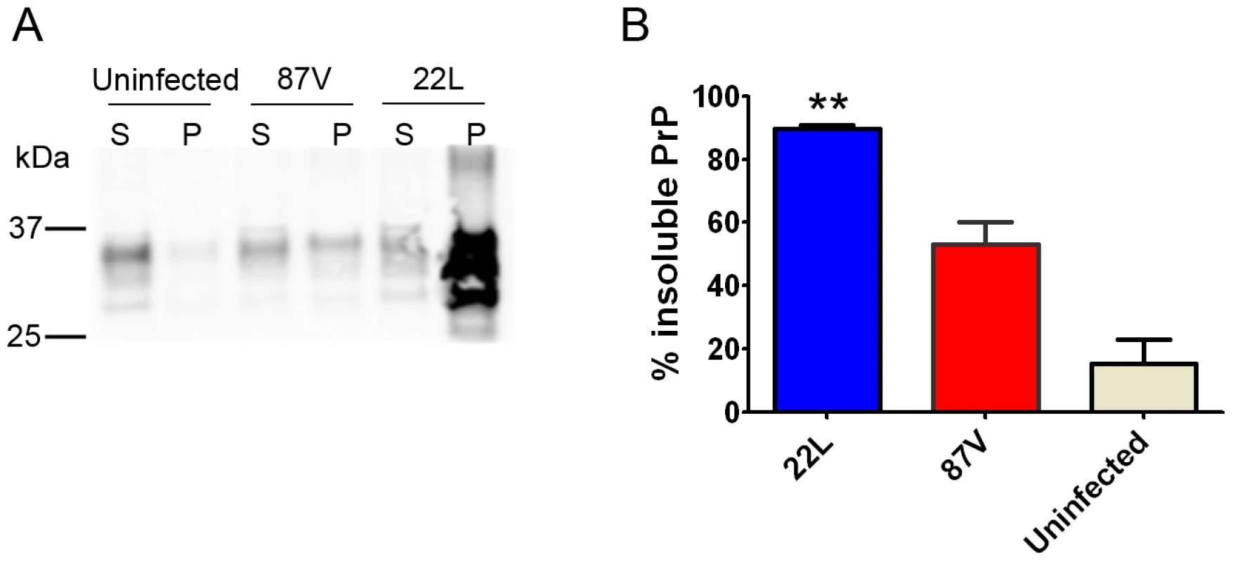 Soluble to insoluble PrP ratio varies depending on the prion strain.
