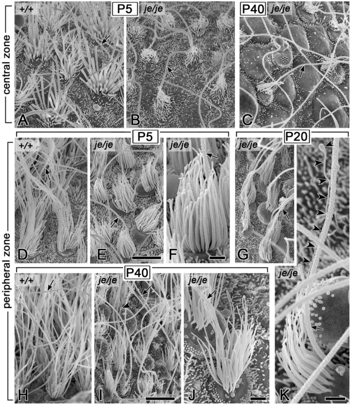 Morphogenesis defects and degeneration of vestibular hair cell stereocilia in cristae ampullares of <i>je/je</i> mice.